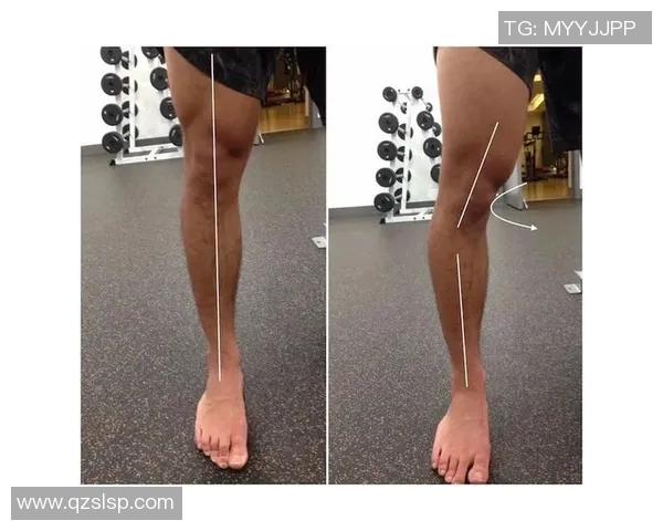 O型腿足球明星的传奇之路与运动生涯的挑战与成就分析